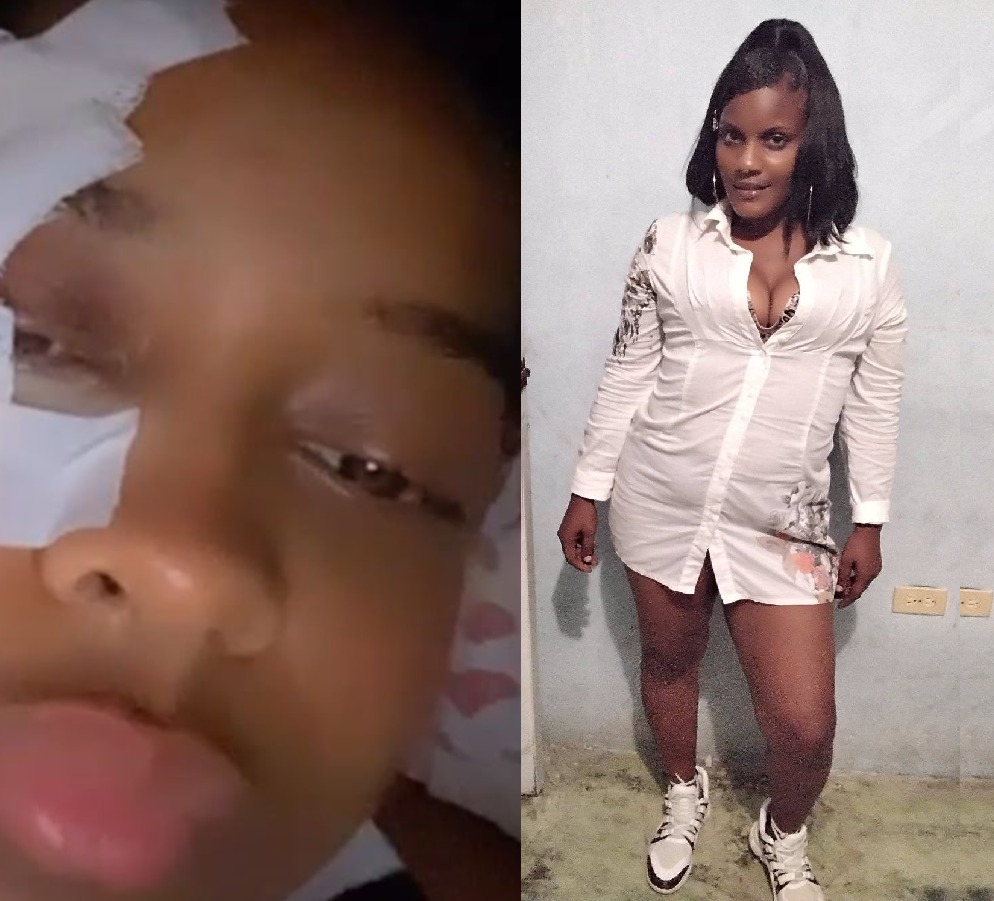 el caso de  joven en Las Cañitas.