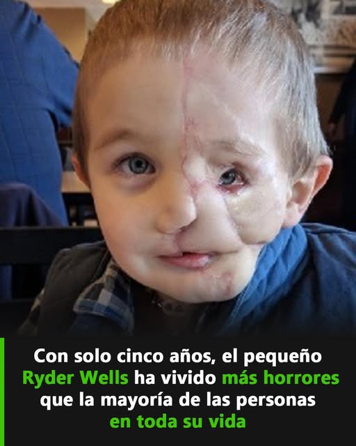 La ciencia médica le regalo un nuevo rostro y su nuevo aspecto es irreconocible.