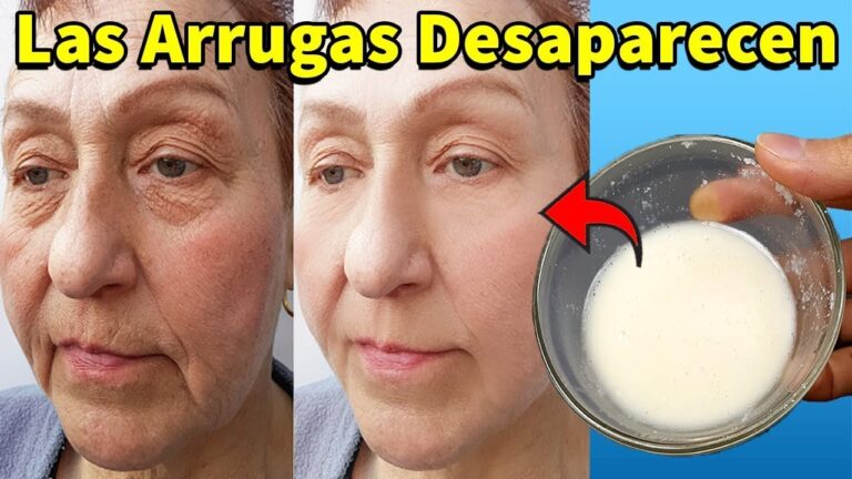 arrugas