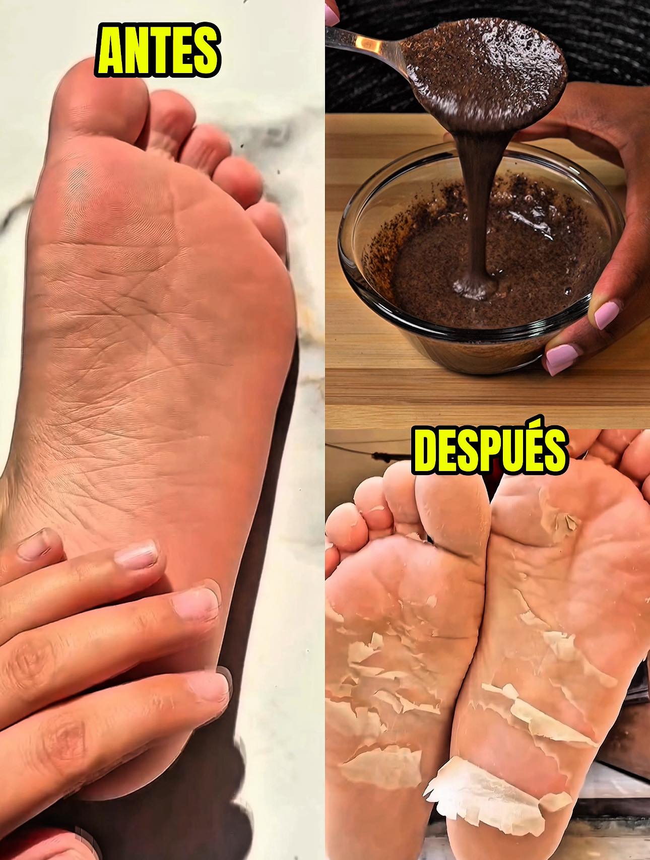 De pies dañados y vergonzosos… ¡a pies de bebé en minutos!