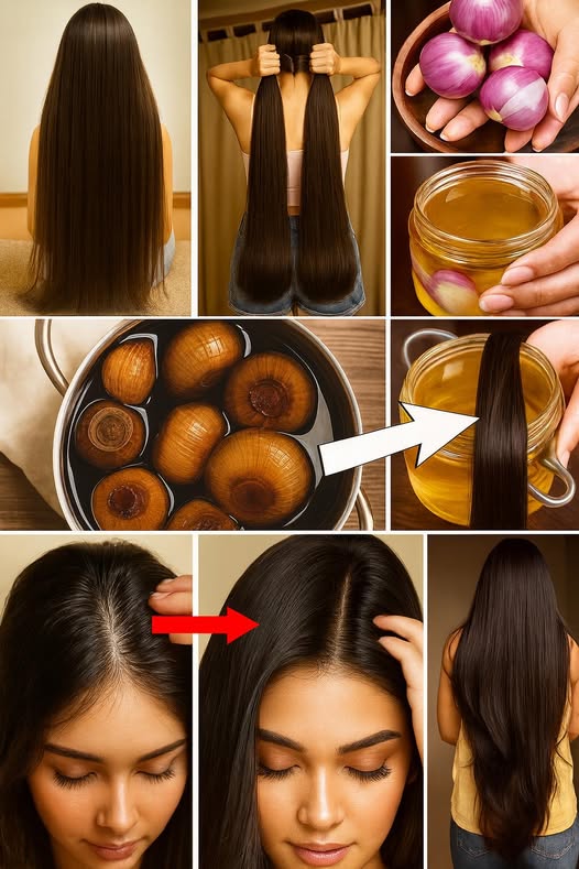 ¿Por qué la cebolla funciona para el crecimiento del cabello?