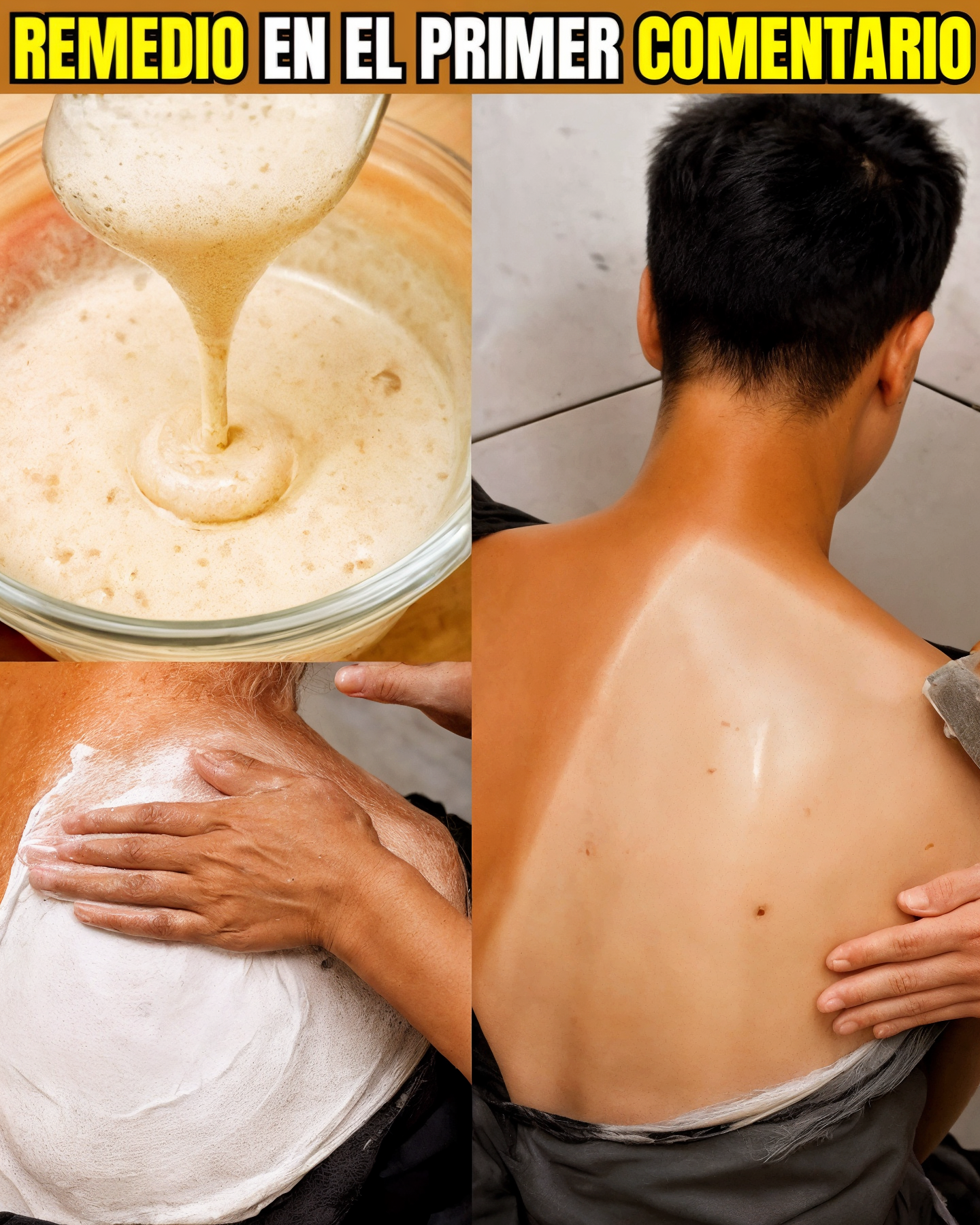 Remedio casero para quemaduras solares y aclarar la piel