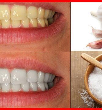 Elimina bacterias y blanquea tus dientes con ajo y sal: receta casera comprobada 🧄🧂
