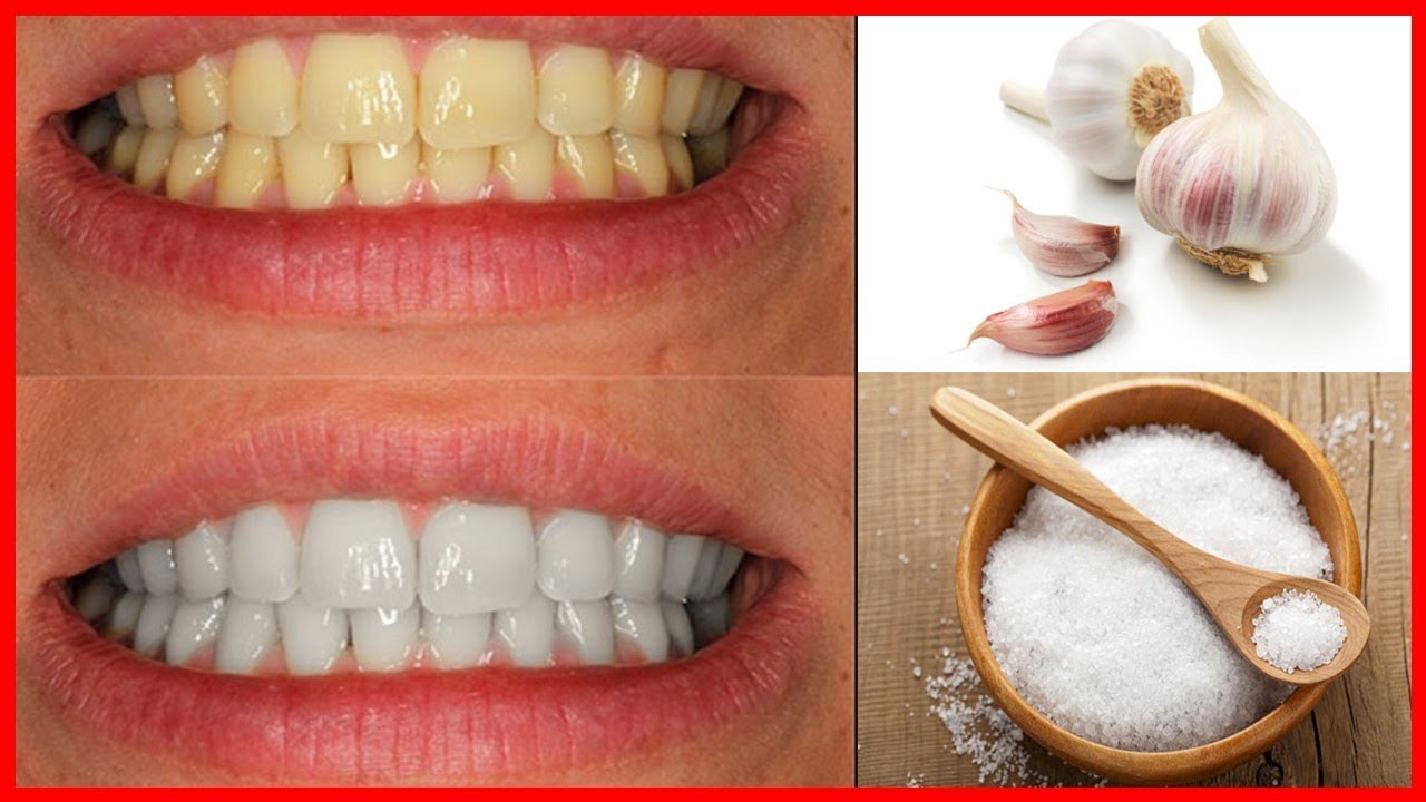 Elimina bacterias y blanquea tus dientes con ajo y sal: receta casera comprobada 🧄🧂