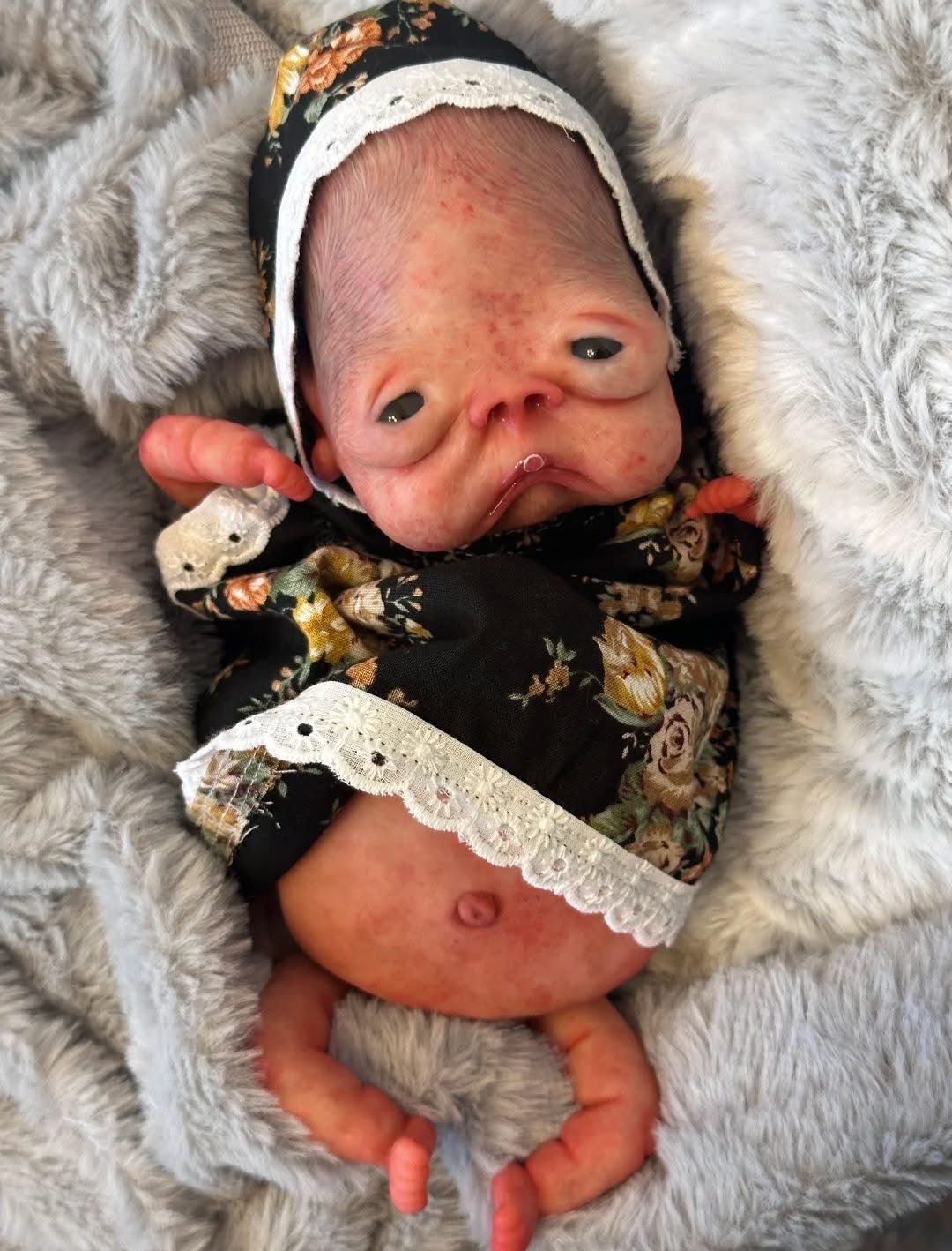 La niña del pañal azul