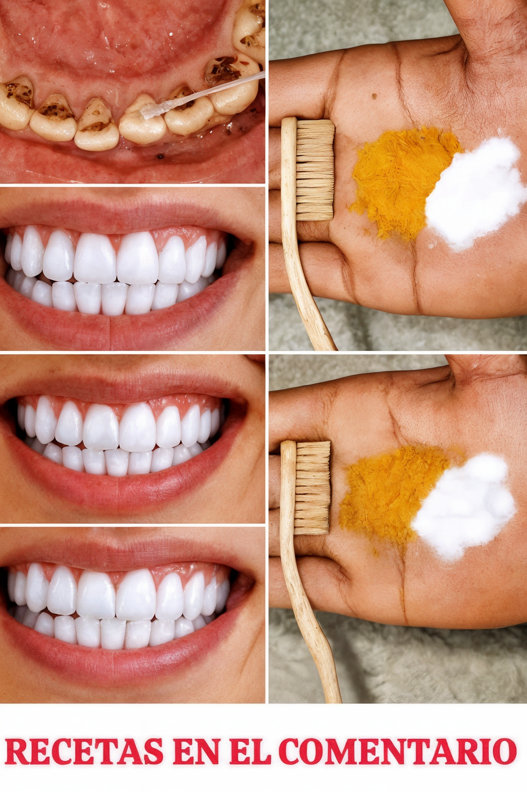 Blanqueamiento dental casero en 2 minutos