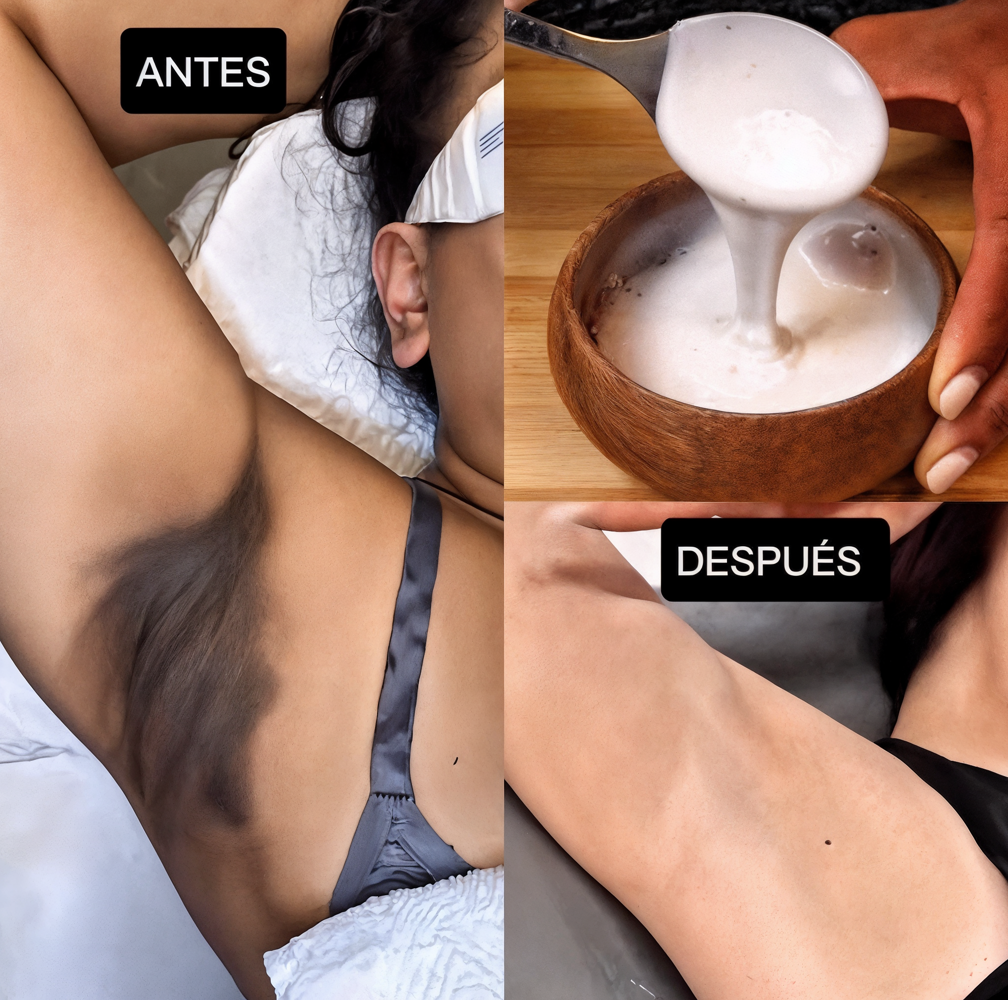 Aclara tus axilas en minutos con solo 2 ingredientes