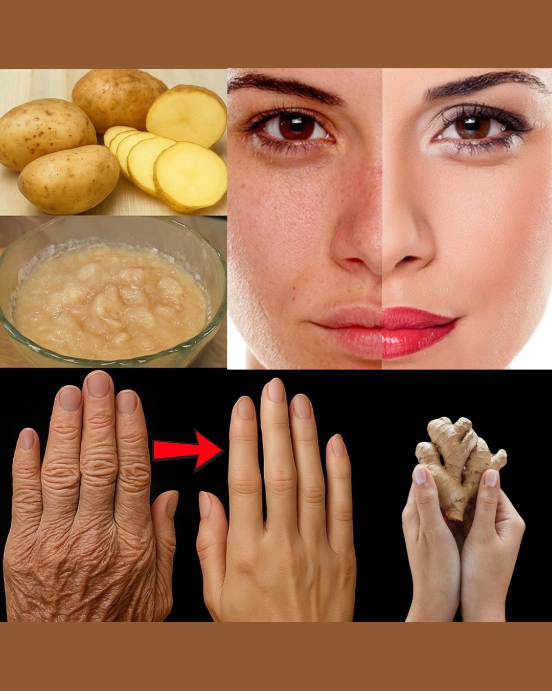 🥔En días parecerás de 20: elimina manchas oscuras y arrugas con este sencillo remedio de papa y jengibre