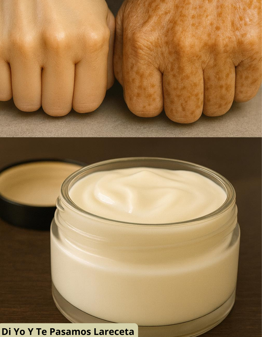 Esta crema facial casera deja tu piel blanca y sin arrugas: tan solo 1 ingrediente