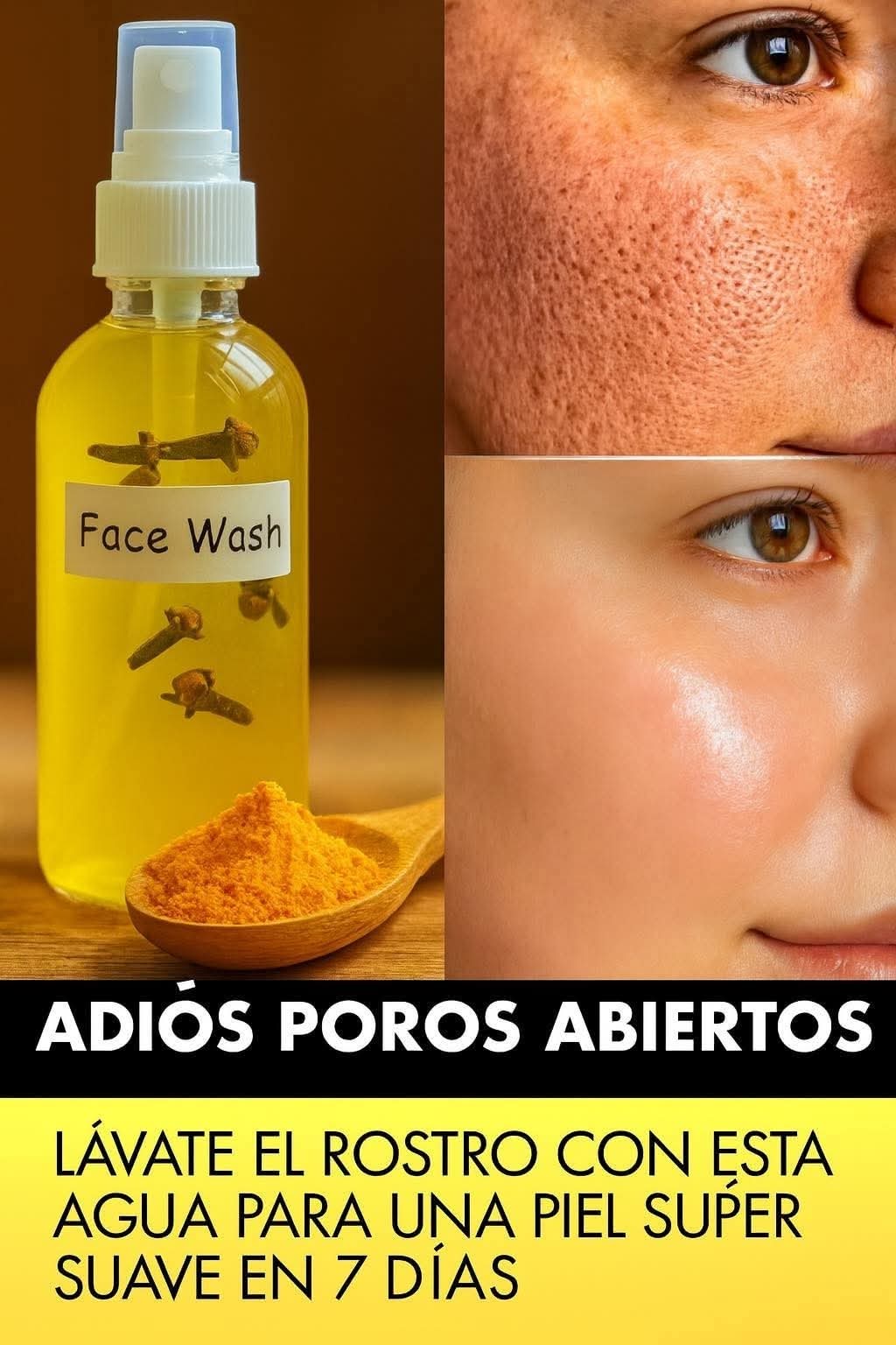 ADIÓS POROS ABIERTOS