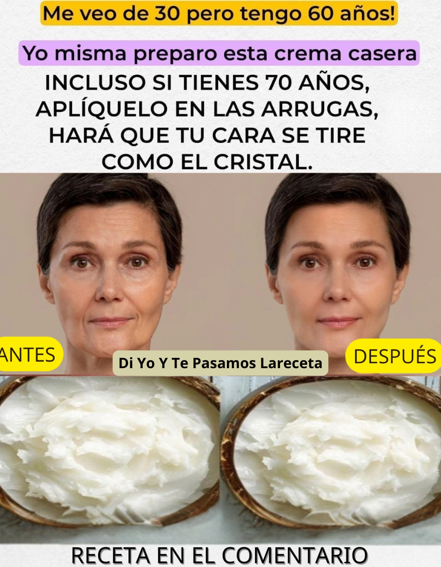 Mascarilla «Lifting» de Noche: Bicarbonato, Miel y Aceite de Coco para Arrugas y Manchas Profundas
