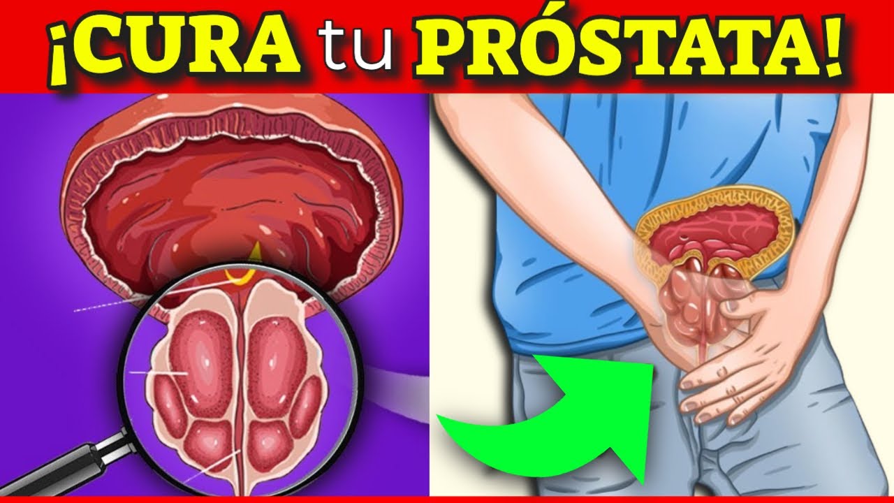 Receta Natural para Desinflamar la Próstata y Recuperar un Flujo Fuerte