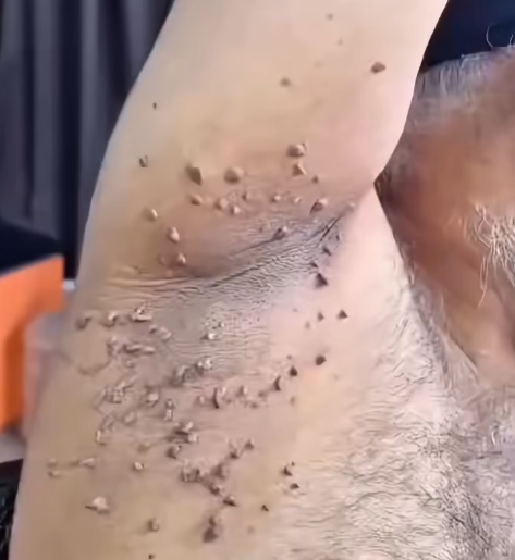 La Piel Queda Limpia y Suave Como Nunca