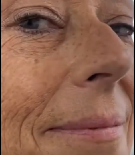 La Mascarilla Milagrosa que Borra Arrugas, Manchas y Cicatrices al Instante