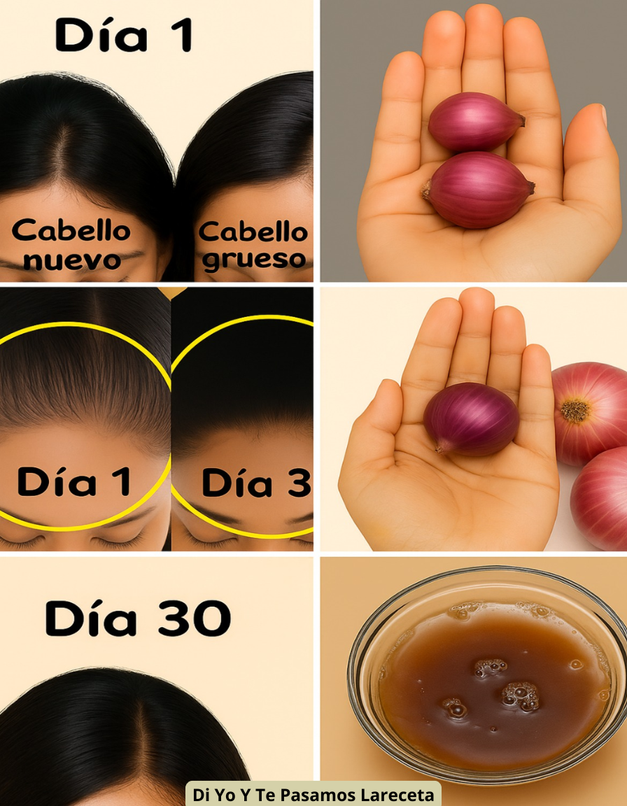 Quieres lucir un cabello hermoso y radiante, elimina caspa