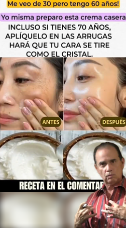 Prepara la crema de bicarbonato, póntela antes de dormir. Adiós arrugas y manchas