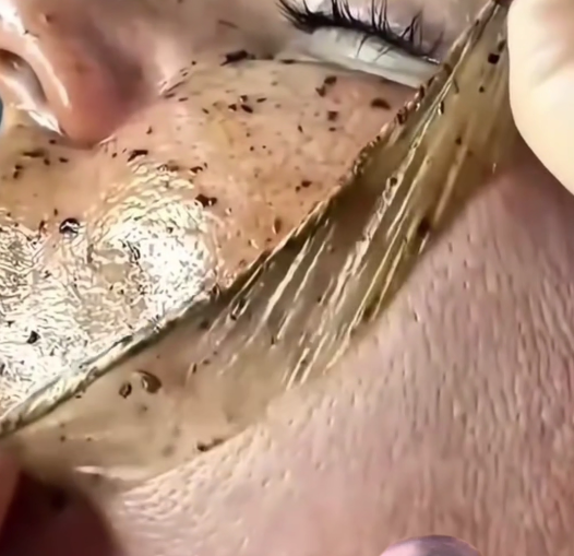 ✨ Mezclé Huevo Azúcar y Limón y mi Piel Cambió por Completo