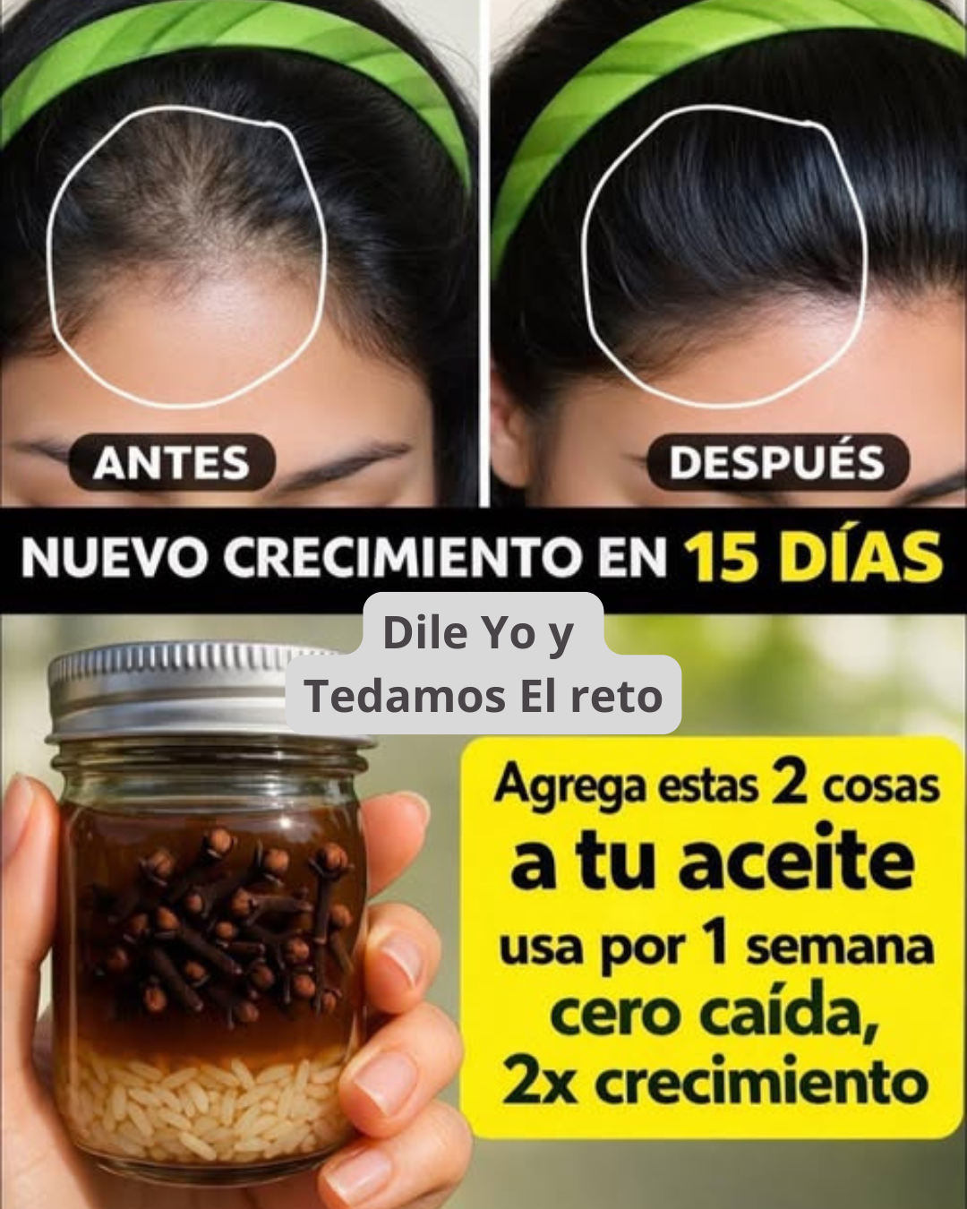 Aceite de arroz y clavo: un cuidado capilar que fortalece, nutre y promueve un crecimiento más saludable