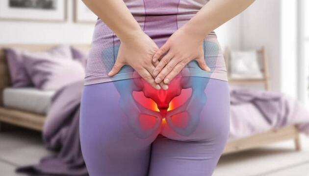 Desviación del Coxis en Mujeres: Causas, Síntomas y Tratamientos (Explicado a Detalle)