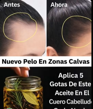Aceite herbal para fortalecer el cabello y cuidar el cuero cabelludo