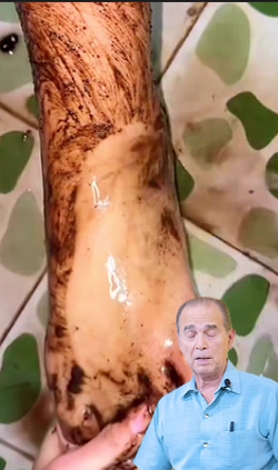 El truco coreano para aclarar la piel