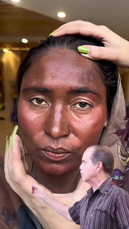 Mira cómo aclaré mis manchas en minutos… sin gastar un peso