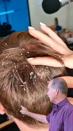 Shampoo Casero para Lucir un Cabello Limpio y Libre de Caspa: La Receta Natural que Tienes que Probar