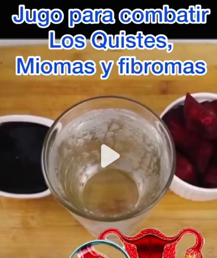 Remedio Jugos para conbatir los quites miomas y fibromas