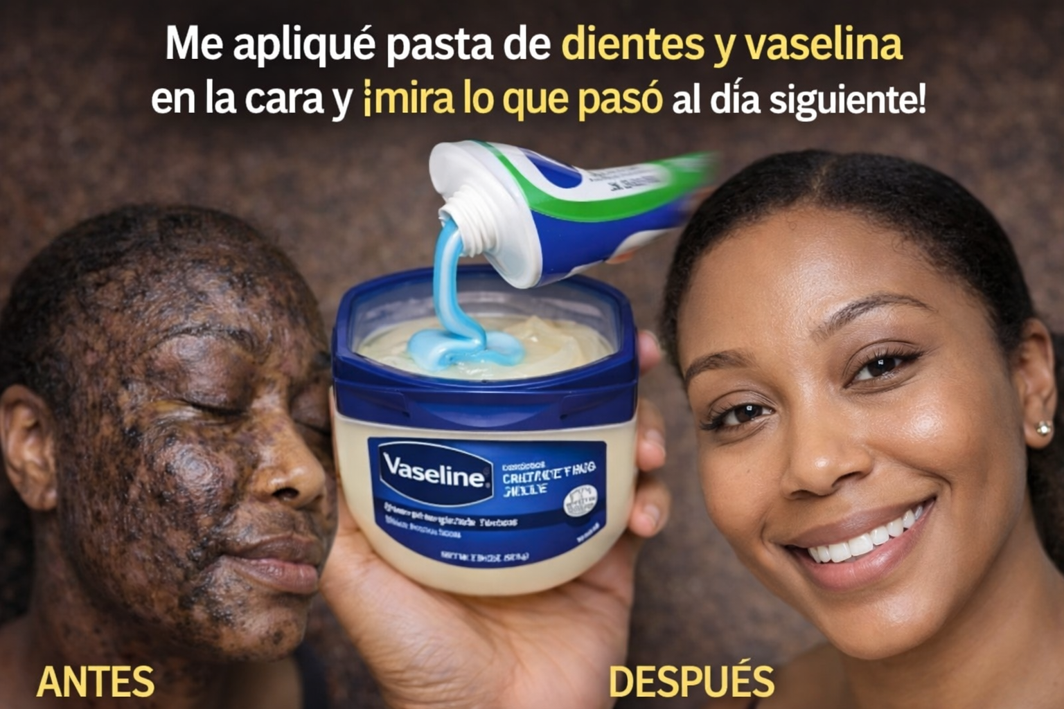 Me apliqué pasta de dientes y vaselina en la cara y ¡mira lo que pasó al día siguiente!