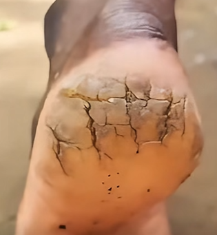 Mezcla pasta dental con azúcar y descubre por qué tantas personas dicen que “se lo agradecieron”