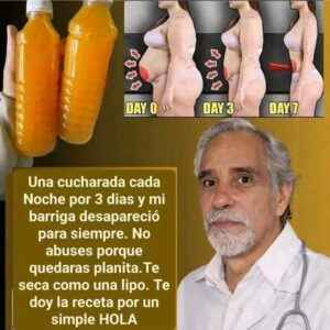 reducir la hinchazón abdominal