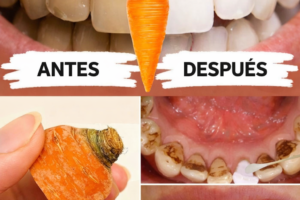 Blanqueamiento dental en casa: ¡dientes más blancos en solo 2 minutos!