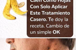 Cáscara de Plátano y Otros Ingredientes Naturales para el Cuidado de las Verrugas