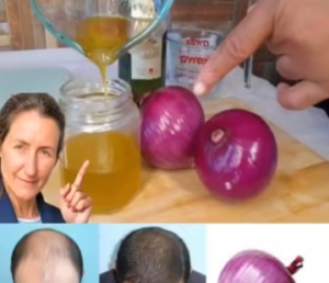 El Elixir de la Cebolla