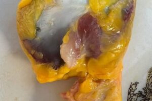 Molleja de pollo: lo que realmente pasa en tu cuerpo cuando la consumes