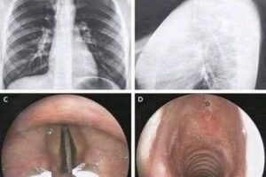 😨 Lo que muchos están descubriendo sobre las vacunas COVID y ciertos efectos inesperados