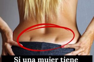Hoyuelos de Venus: lo que realmente significan y por qué aparecen