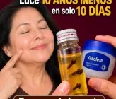 Vaselina con clavo de olor